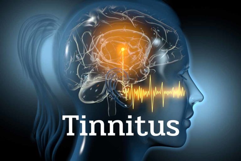 Tinnitus Research Initiative Conference NLASLPA